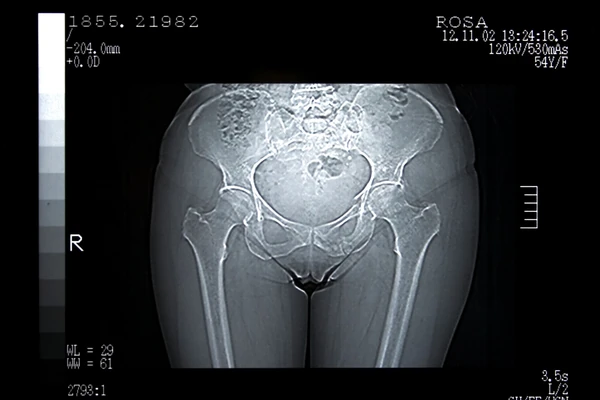 Devojka (22) došla na MAGNETNU REZONANCU, a čim su uključili uređaj počela je da VRIŠTI U AGONIJI: Lekari kad su videli šta je imala u ANALNOM OTVORU uhvatili se za glavu 