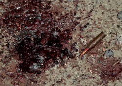 Krwawe walki w Doniecku. Ofiary wśród cywilów. DRASTYCZNE ZDJĘCIA