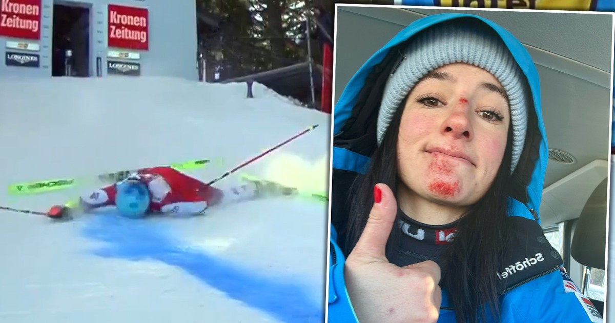Katharina Huber upadł tuż po starcie. Alpejka pokazała obrażenia twarzy