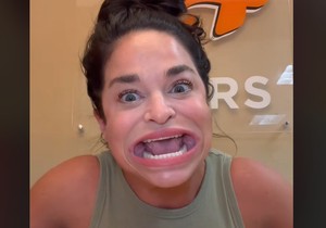 Samanta - žena sa najvećim ustima na svetu