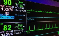 Groźne bezobjawowe migotanie przedsionków. Można zgłosić się na badania