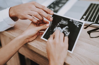 A kisbabám nyakára duplán rá van tekeredve a köldökzsinór, mit lehet tenni? Az orvos válaszol