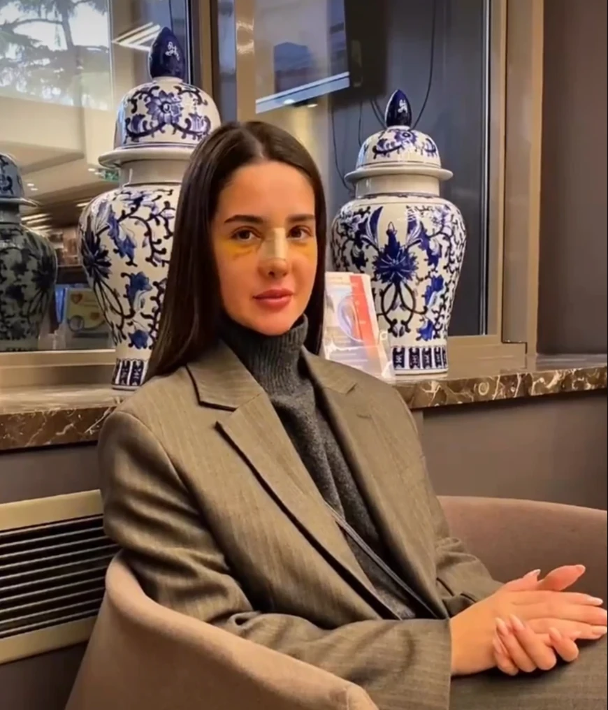 OTEČENO LICE I FLASTERI! Prva slika Anđele Đuričić nakon operacije u Turskoj: "ŠTA SAM TRAŽILA, TO SAM DOBILA!" (FOTO)