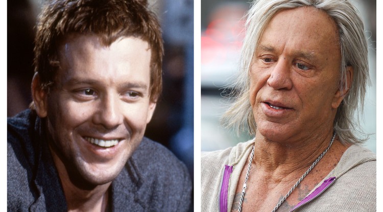 Mickey Rourke plasztika előtt és után