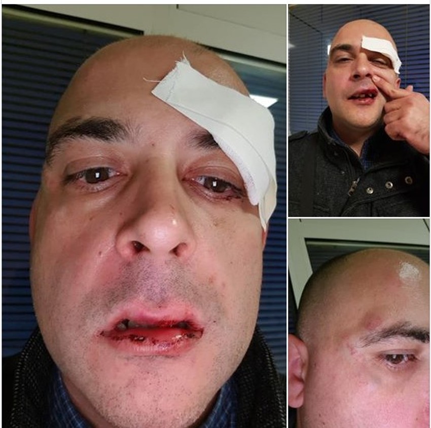 Ilija Vučević dan nakon napada