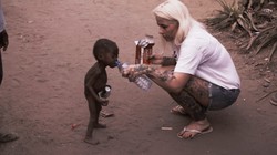 To zdjęcie obiegło cały świat. Jak teraz wygląda chłopiec uratowany przed śmiercią?