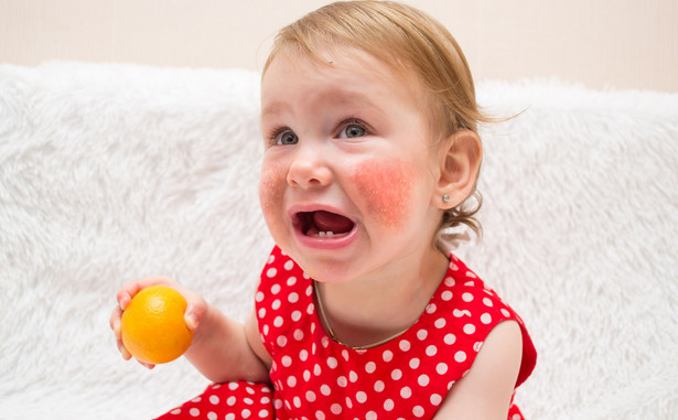 Dziecko ma alergię na cytrusy? 5 najczęstszych objawów