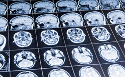 Długi pobyt w kosmosie wpływa na mózgi astronautów. Jak bardzo?