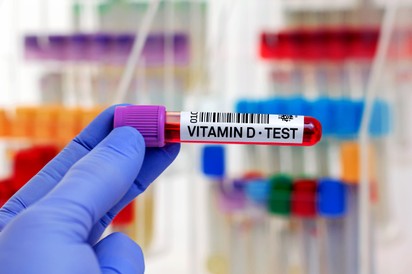 D-vitamin szint: kockázatot jelent, ha nincs legalább ennyi a szervezetben