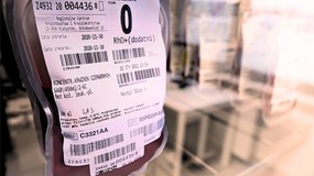 Do 500 zł dla dawców rzadkich grup krwi w 2025 r. Ministerstwo ujawniło listę – kto dostanie pieniądze?