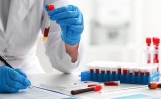 Centralne krwiolecznictwo potrzebne