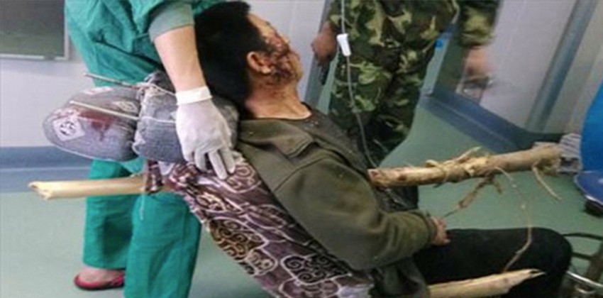 Niko nije verovao da će Li preživeti