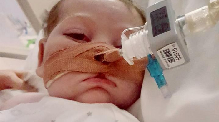 Kampány indult Charlie Gard megmentéséért/ Fotó:Facebook