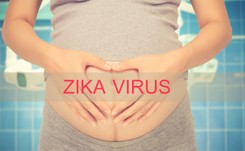 Czy Polkom grozi wirus Zika? Eksperci tłumaczą