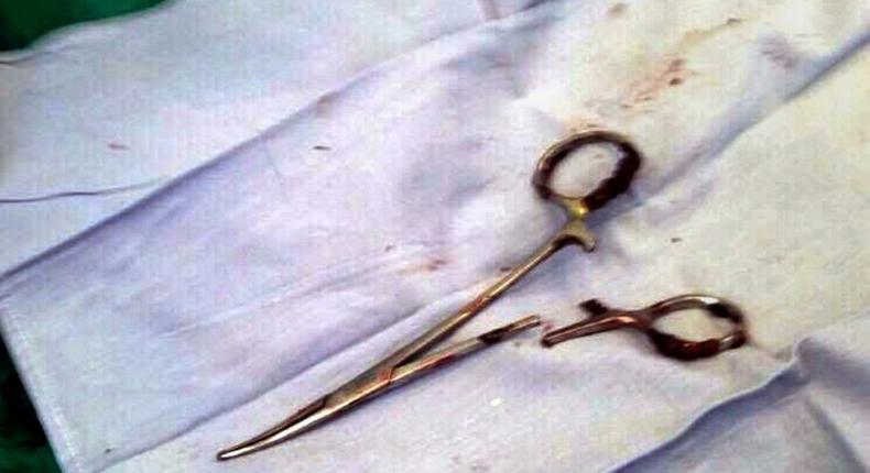 A pair of scissors which was removed from a patient's abdomen after being left behind during a surgery 18 years ago, at a clinic in the northern Vietnamese city of Thai Nguyen