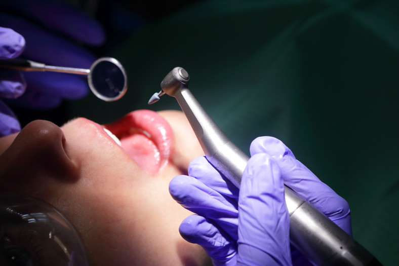 Wizyty u stomatologa mogą kosztować sporo bólu i pieniędzy