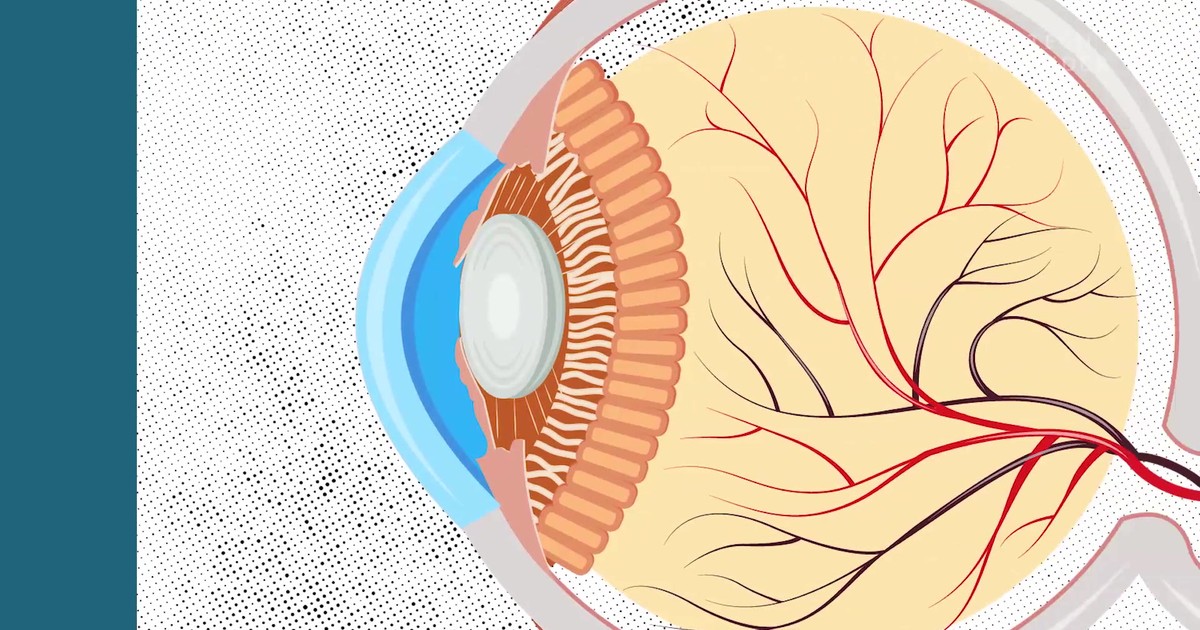 What happens when you sleep in your contacts Pulse Ghana