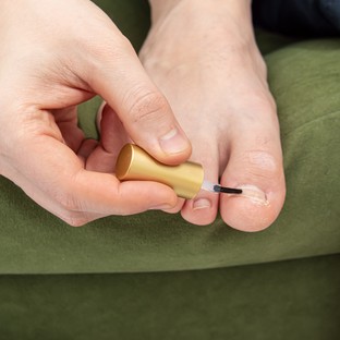 Mitől zöldülhet be a köröm? A bőrgyógyászok szerint ez az elváltozás oka