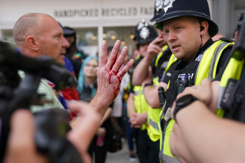 Protesti u Britaniji nakon ubistva dece u Sautportu - Notingem 3. avgusta