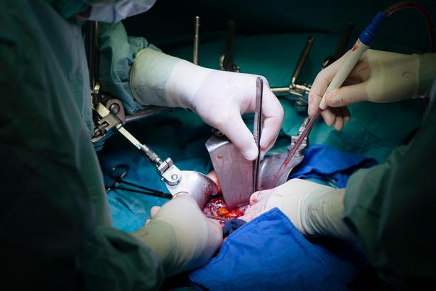 Surgeons transplanting a liver