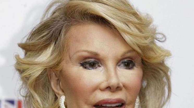 Elhunyt Joan Rivers