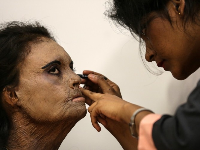 Ofiary ataków kwasem w roli modelek