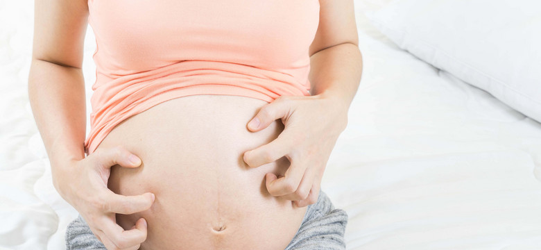 Wysypka po porodzie. Jak złagodzić jej objawy?