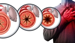 Epizode ​​bronhospazma su uznemirujuće i zastrašujuće