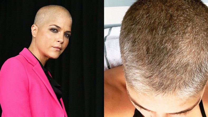 Selma Blair Shares Update On Hair Growth Amidst Multiple Sclerosis