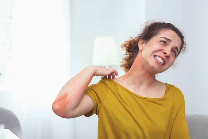 Odjednom me je spopao neopisiv svrab, svuda po koži, a najviše u predelu dekoltea