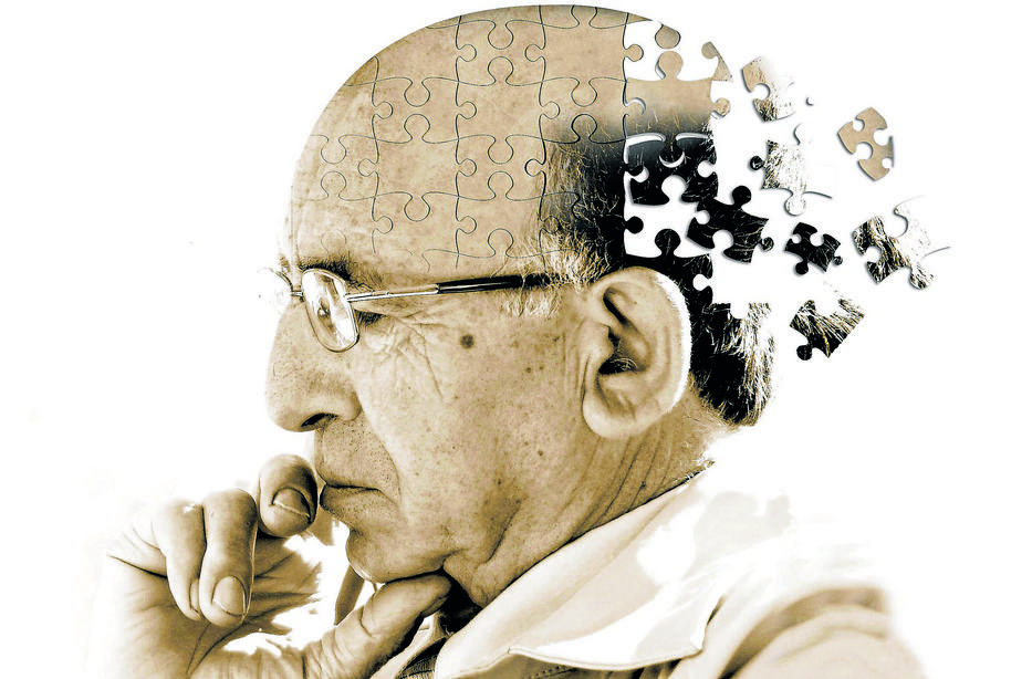 Az orvosok ledöbbentek: Alzheimer-kóros betegek, akiken nem fog a butulás