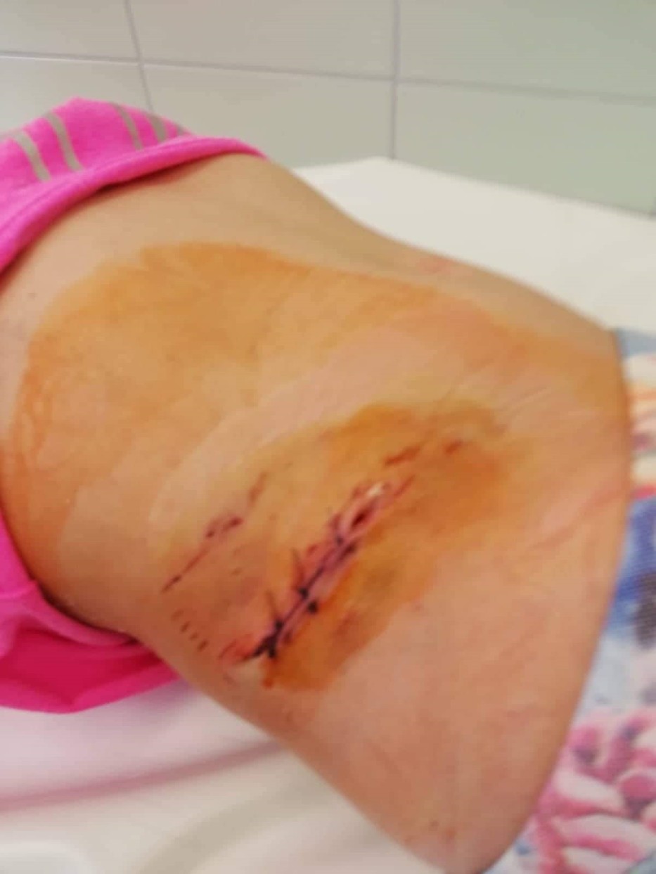 Az árulkodó fotó közvetlenül a kislány operációja után készült, 2019-ben 