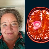 Félrediagnosztizálták, majd kiderült, csak 18 hónapja maradt az életből az anyának