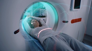 Mi a különbség az MR és az MRI vizsgálat között?
