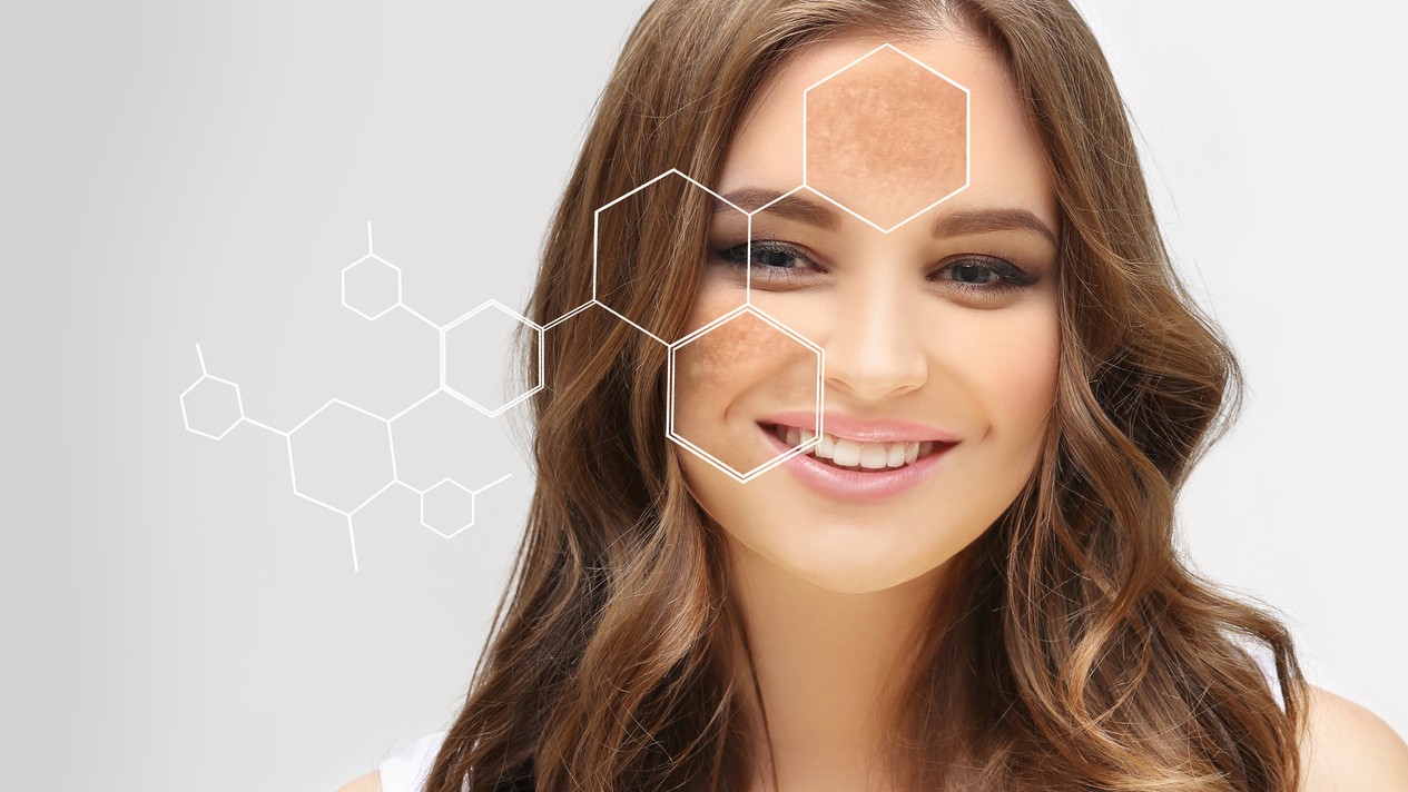 Hyperpigmentácia je pomerne bežný kožný jav, ktorý sa prejavuje stmavnutím určitých oblastí pokožky v dôsledku nadmernej produkcie melanínu.