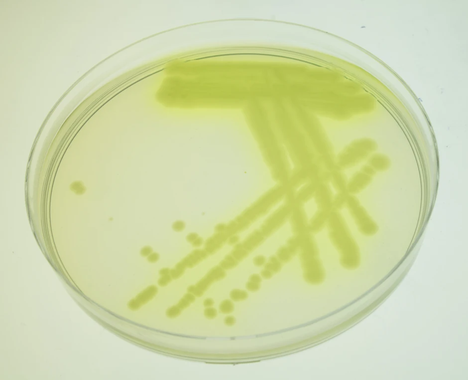 Bakterija Pseudomonas aeruginosa je veoma otporna na bakterije