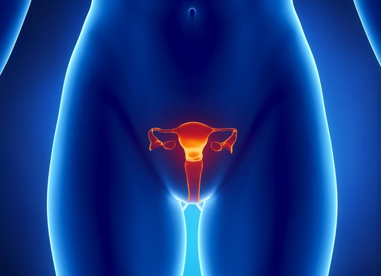 Mit 6: Endometrioza to przerost endometrium w macicy.