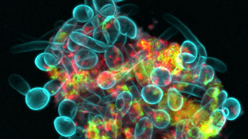 Zgromadzenie bakterii (Streptococcus mutans, zielone) i grzybów (Candida albicans, niebieskie) w ludzkiej ślinie