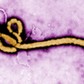 Wirus Ebola wirusy choroby zdrowie epidemie