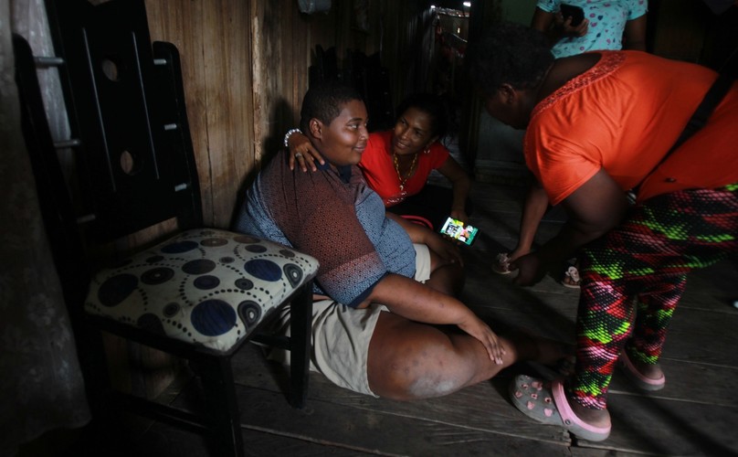 WALCZY O ZDROWIE, ZRZUCIŁ 50 KILOGRAMÓW