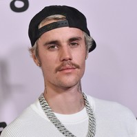 Egy vírus miatt lebénult Justin Bieber fél arca