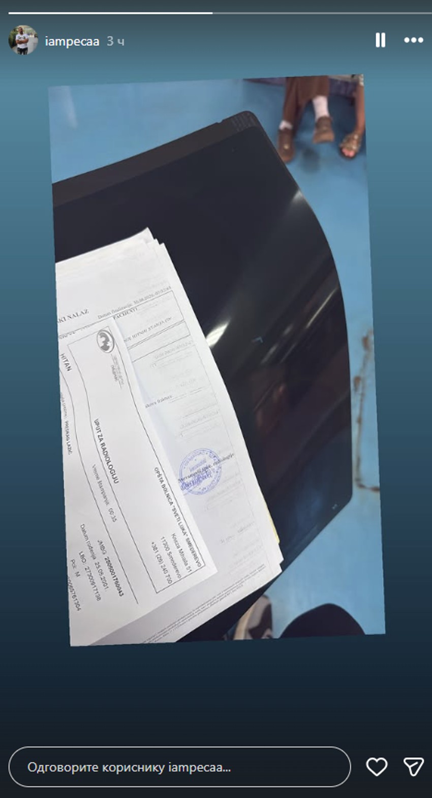 Peca Lazić završio u Urgentnom, pokazao nalaze nakon jezivog napada