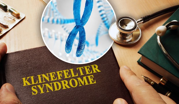 Klinefelterov sindrom je urođeno stanje koje pogađa isključivo muškarce