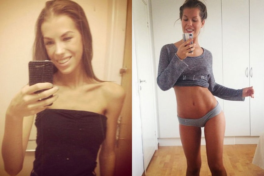 Antonia Eriksson Szwedka walczy z anoreksją na Instagramie