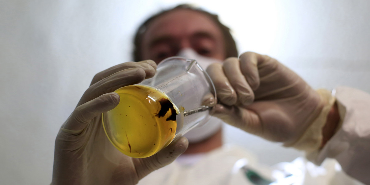 Grower Denis Contry prepares medicinal oil with marijuana extract.