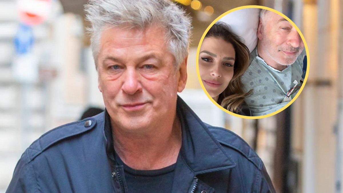 Alec Baldwin musiał przejść operację. Czuwa przy nim żona