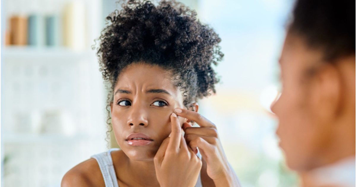 6-foods-that-can-aggravate-your-acne-pulse-ghana