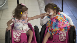 Milliók szurkoltak Eváért és Erikáért: így élnek a sikeres műtét után a szétválasztott sziámi ikrek - fotók