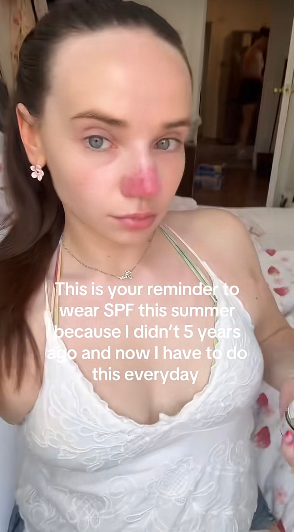 Jessica McGirr teraz denne používa opaľovací krém s SPF 50 a premýšľa, či má ďalej skúšať nové liečby.