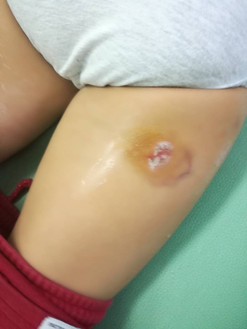 Trebaće vreme da rana prođe